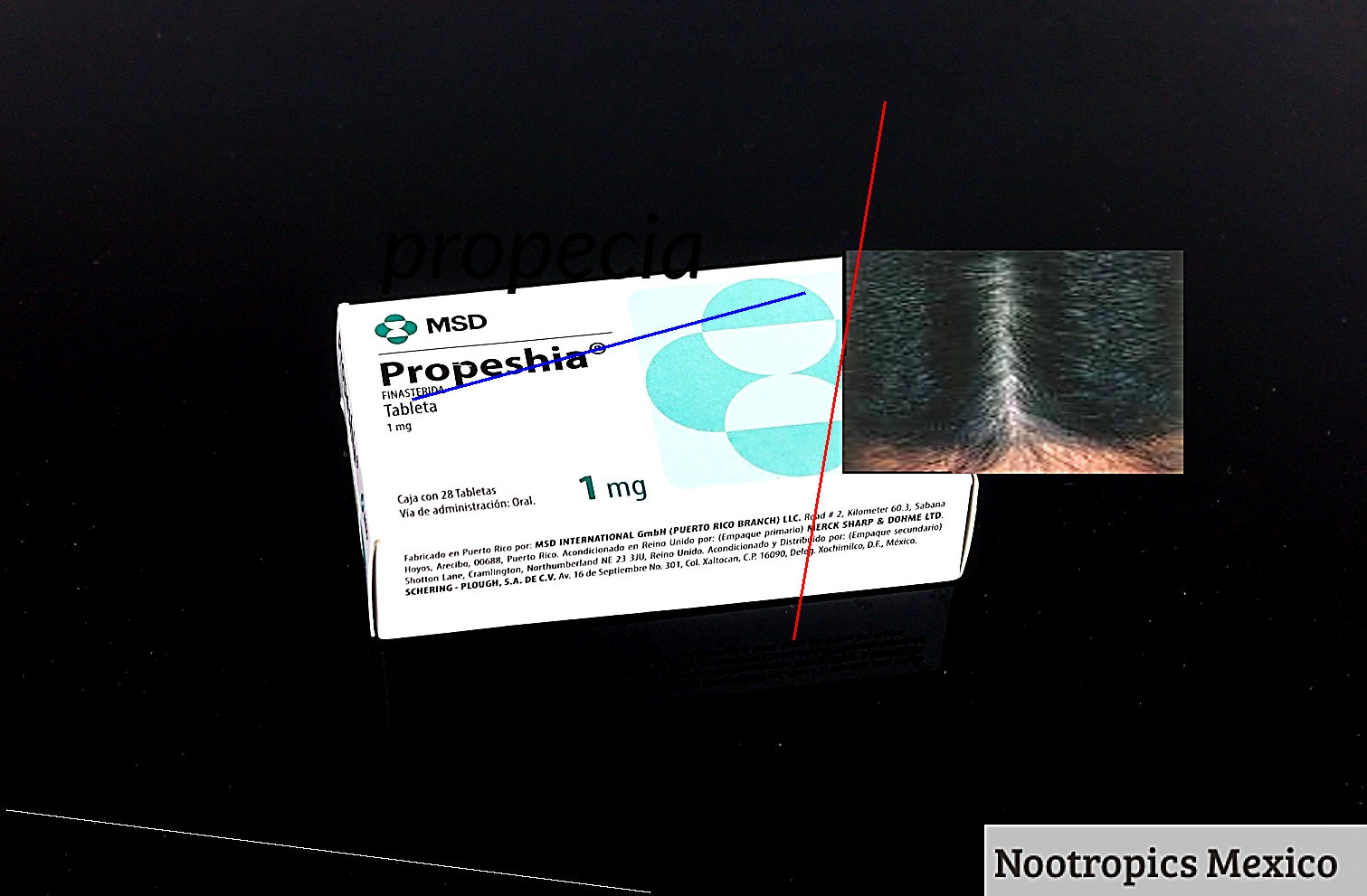 Finasteride propecia achat